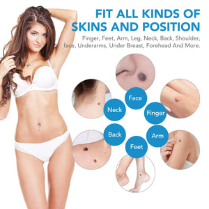 Auto Skin Tag Remover Kit