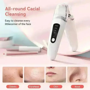CureMe Professional Skin Scraper Device - Bear Hugs