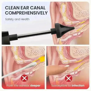 Hydro Helper Ear Wax Removal Kit - Bear Hugs