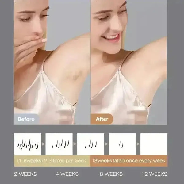 IPL Laser Hair Removal Device (9,99,999 Flashes) - Bear Hugs