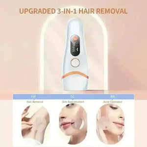 LYSMOSKI IPL Pulse Light Hair Removal Device - Bear Hugs