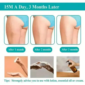 Versatile Cellulite Body Sculpting Machine - Bear Hugs