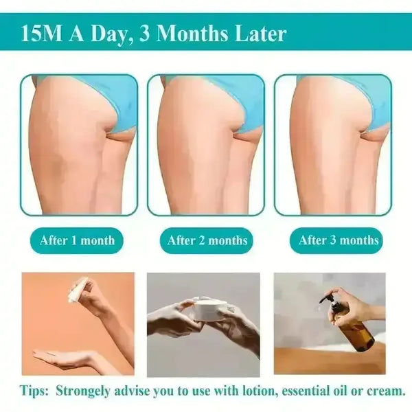 Versatile Cellulite Body Sculpting Machine - Bear Hugs