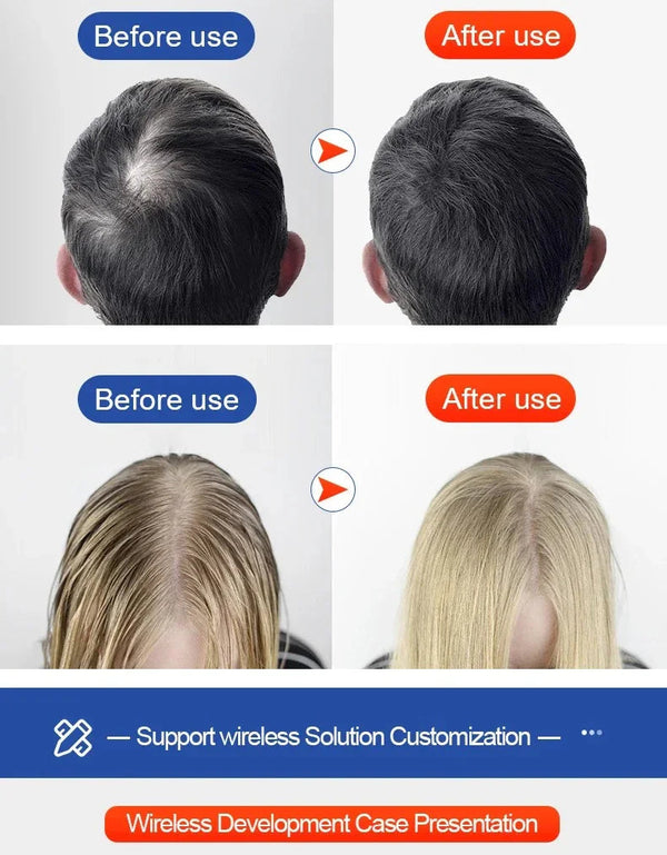 AuraRoot Hair Rejuvenation Cap