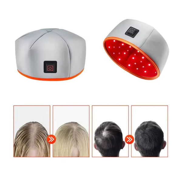AuraRoot Hair Rejuvenation Cap